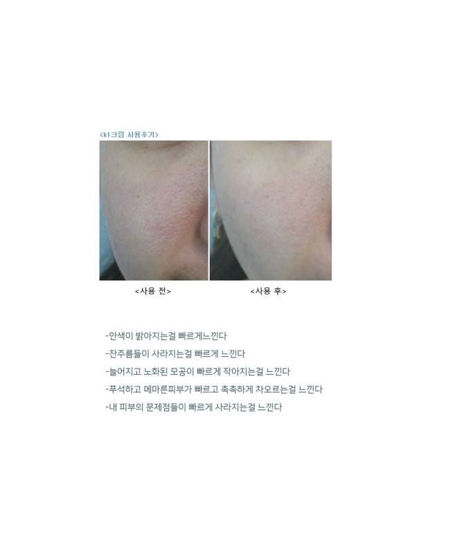 New Salve System Cream K1 Salve System Cream Regen