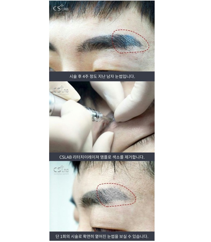 New CS Lab Laser + CS Lab Power Repair Semi-perman