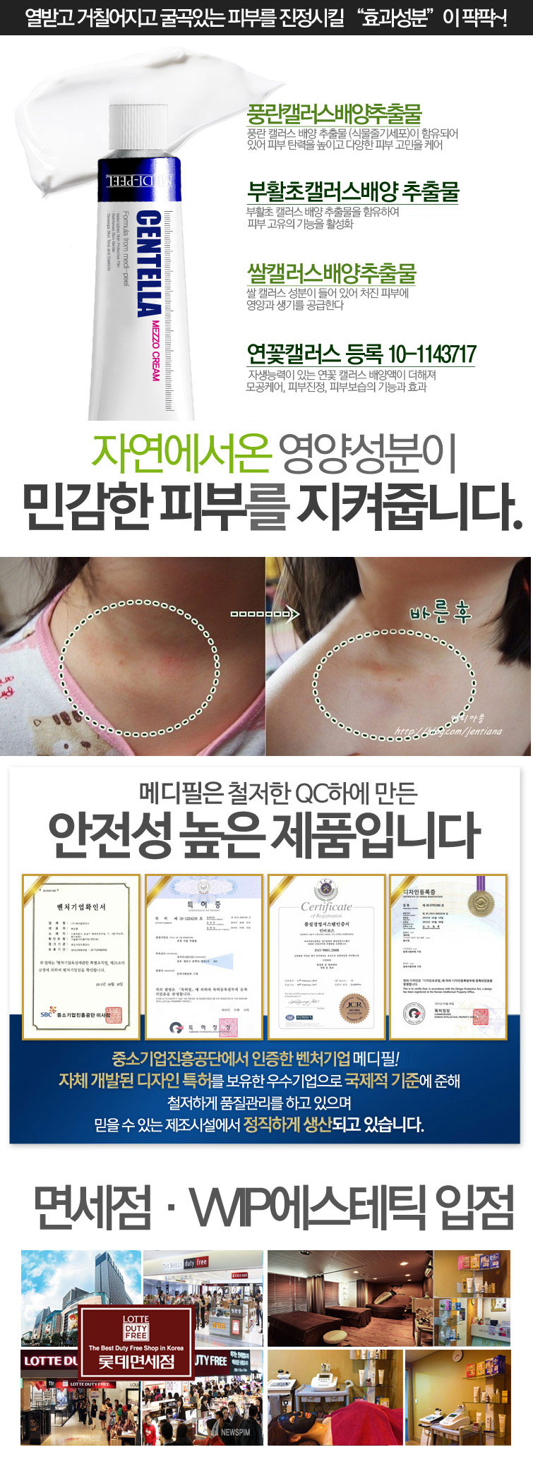 New Medifil Centella Meso Clear Cream 30ml Play Ca