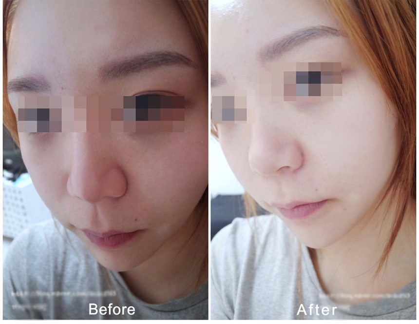 New Anita Skin Care Whitening Cream Toning Kimurae