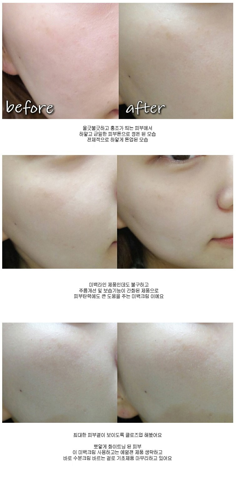 New Anita Skin Care Whitening Cream Toning Kimurae