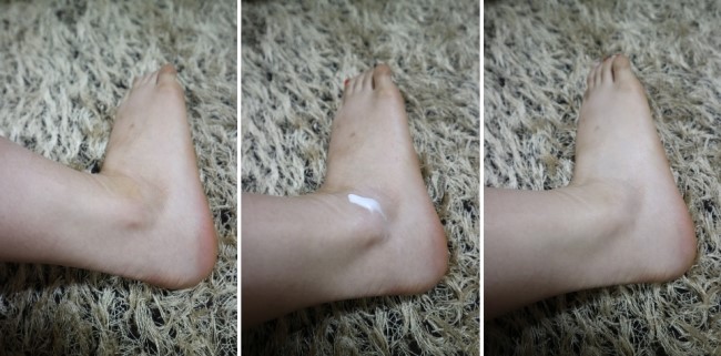 New elbow armpit pigmentation stinging body whole 