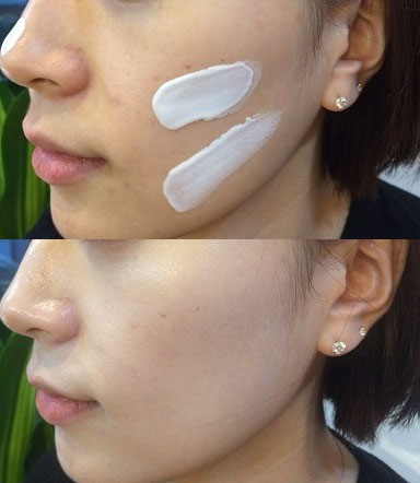 New elbow armpit pigmentation stinging body whole 