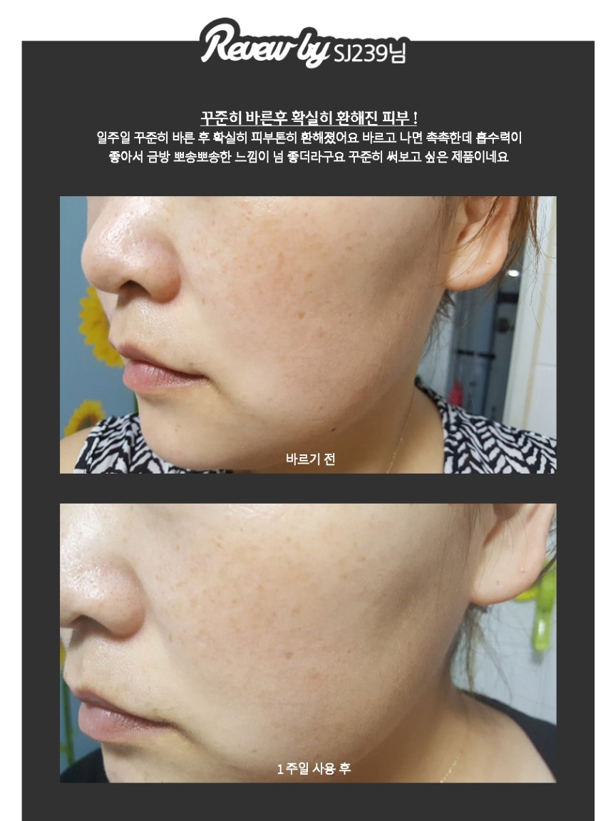 New Anita Skin Care Whitening Cream Toning Kimurae