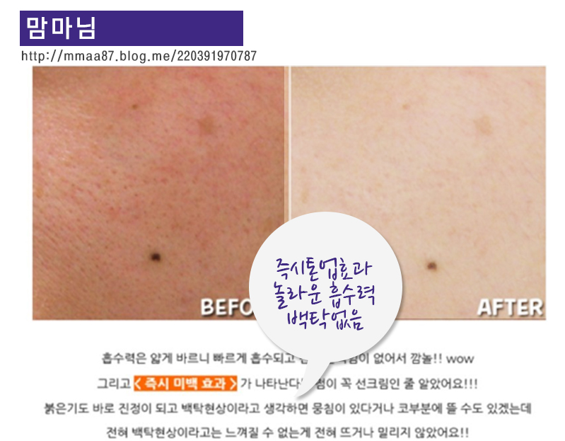 New Hip Crotch Pigmentation Whitening Cream White 