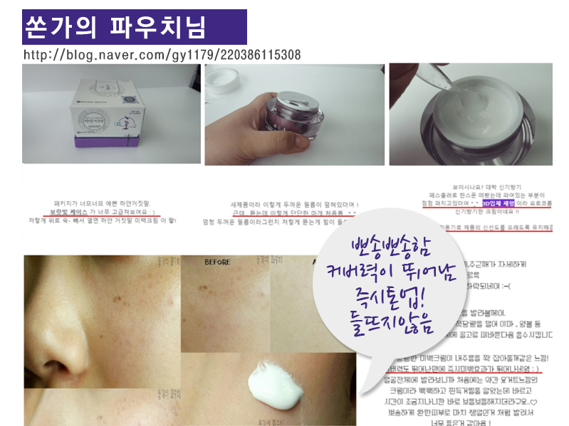 New Hip Crotch Pigmentation Whitening Cream White 