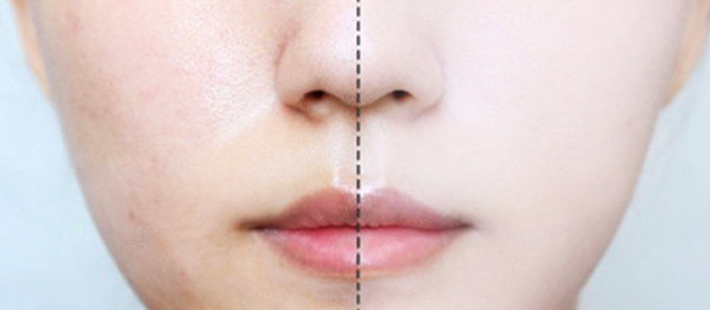 New Dr. Elia Power Whitening Glutathione Cream