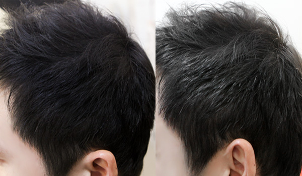 NEW HAIR CARE Dashe Hair Removal Prevention Protei