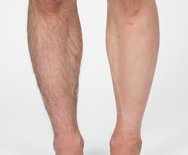 Waxing Thumbarimia Perfect Clear Hair Removal Cream Self-Eyes Factory