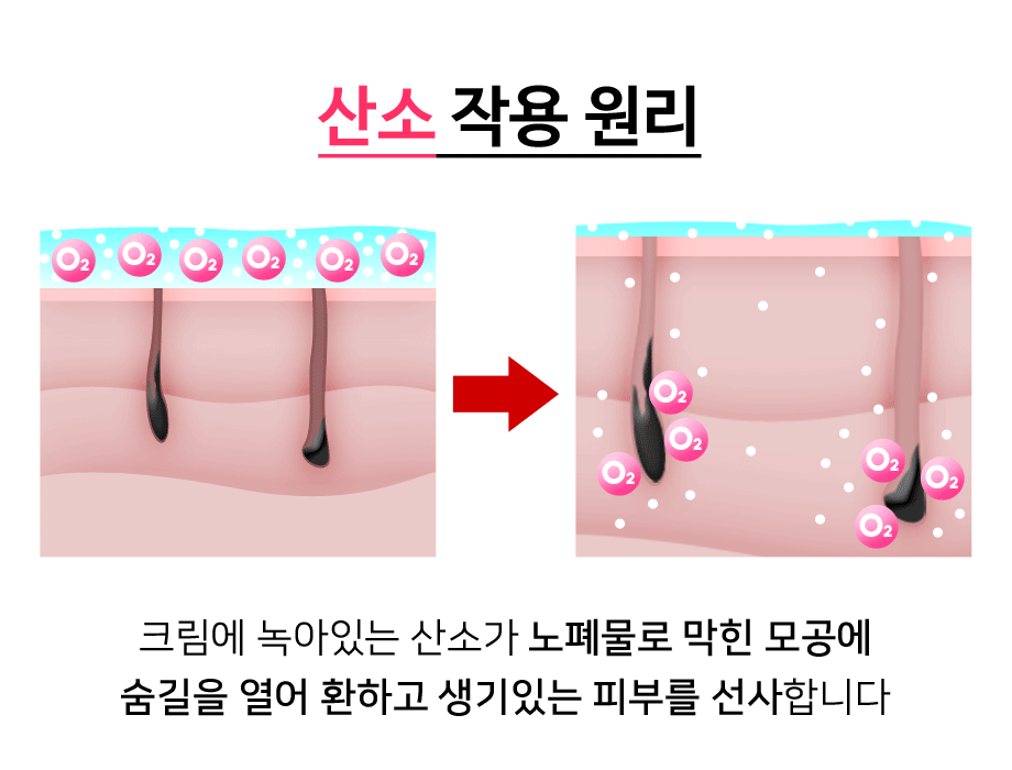 New Route of Miracle Spicule Cream Facial Pics Kne