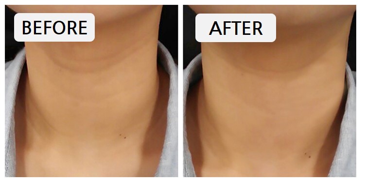 New Firming Touch Solution wrinkle-improving cosme