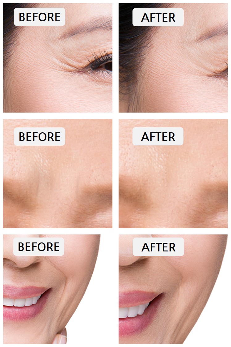 New Firming Touch Solution wrinkle-improving cosme