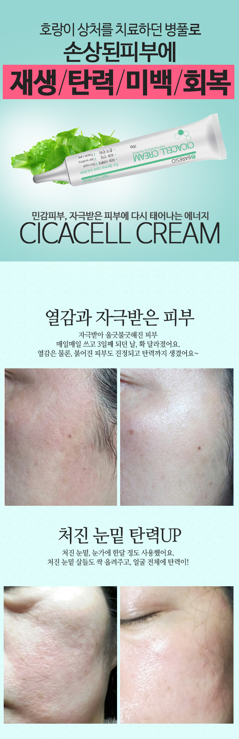 New BARCIO MADECA Whitening Cream Sycacel 20g - Su