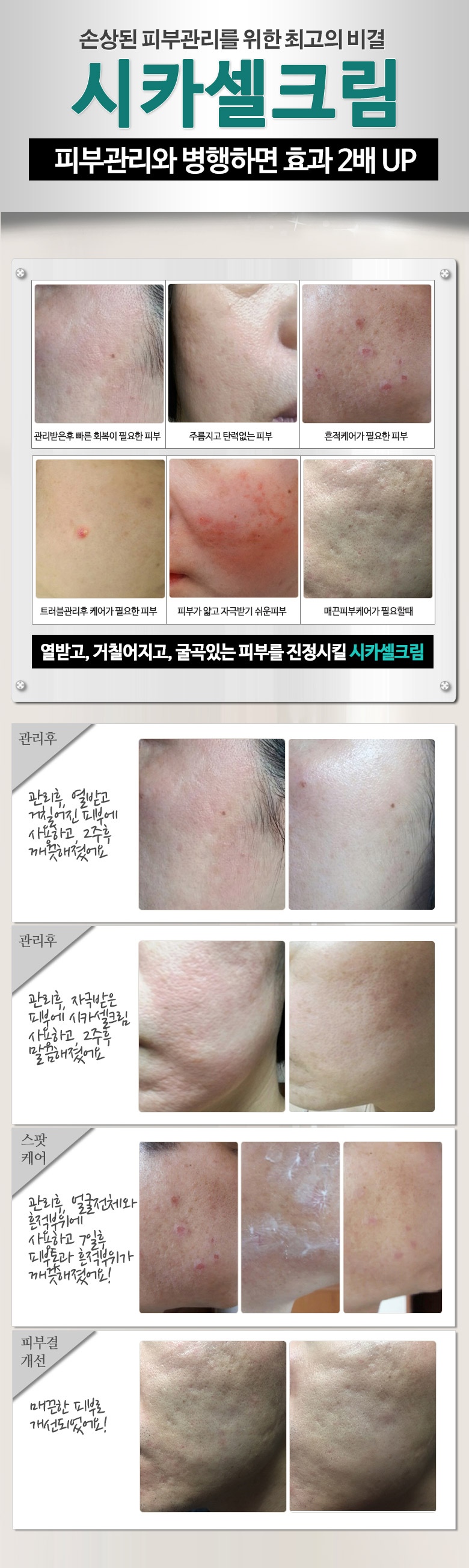 New BARCIO MADECA Whitening Cream Sycacel 20g - Su