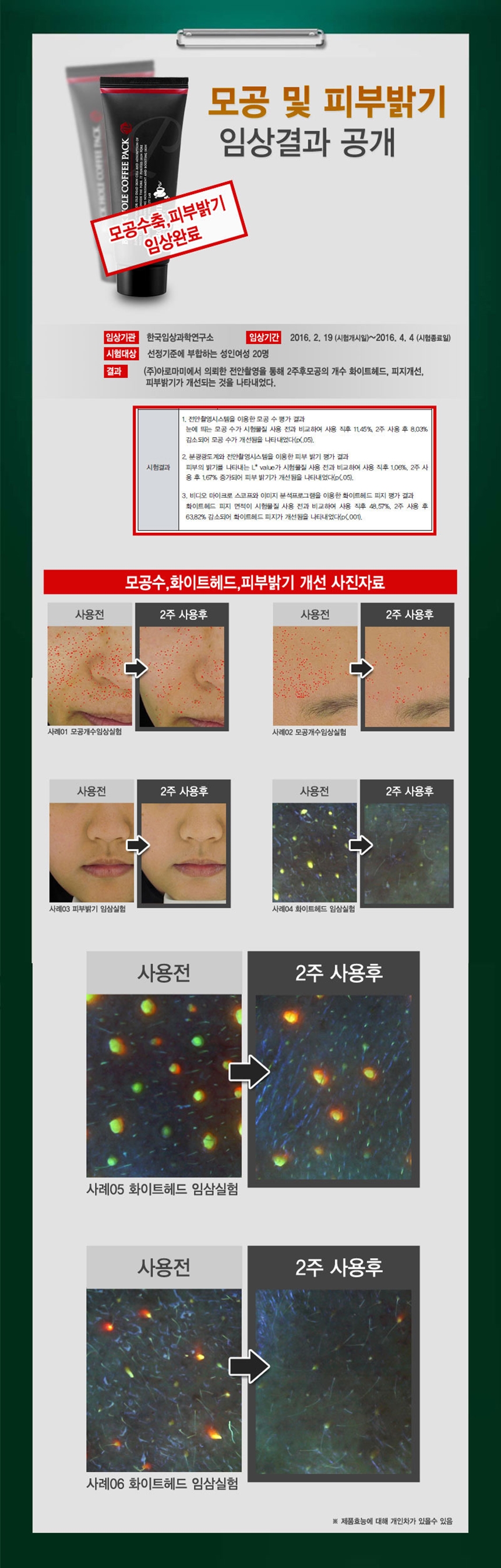 New event whitening cream 50g Aroma whitening func