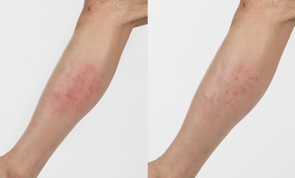 Waxing Thumbarimia Perfect Clear Hair Removal Cream Self-Eyes Factory