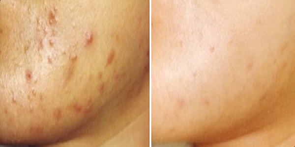 New Papaya Tree Facial Cream 105g Moisturizing ski