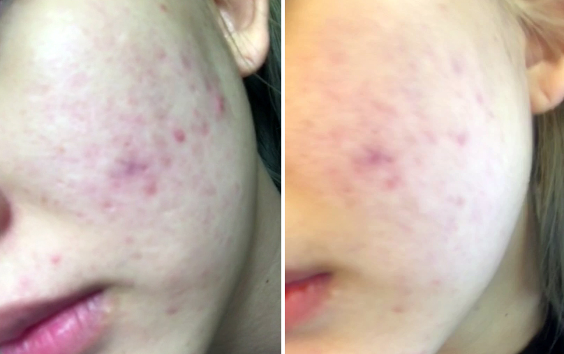 New Mother-Made Aqua Rush Pepta Cream 50mL _ Moist