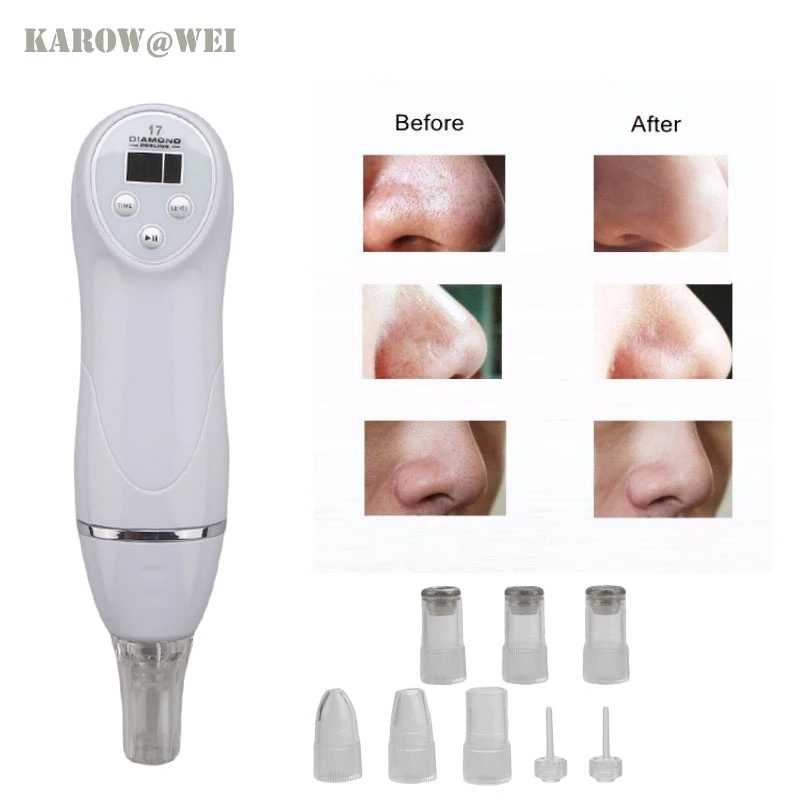 Blackhead Remover Fiji Inhaler Diamond Peeling Mac