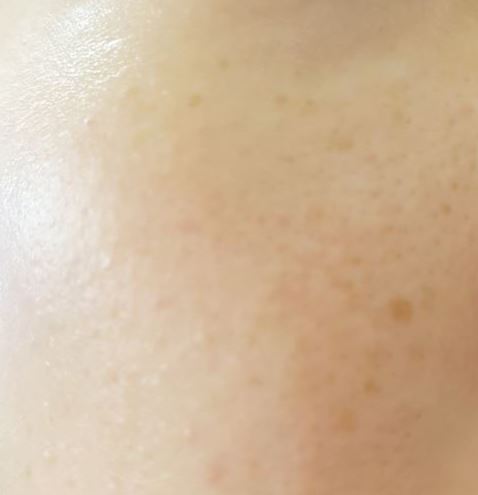 New Beauty Young Blackout whitening cream, spots, 