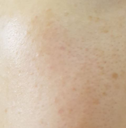 New Beauty Young Blackout whitening cream, spots, 