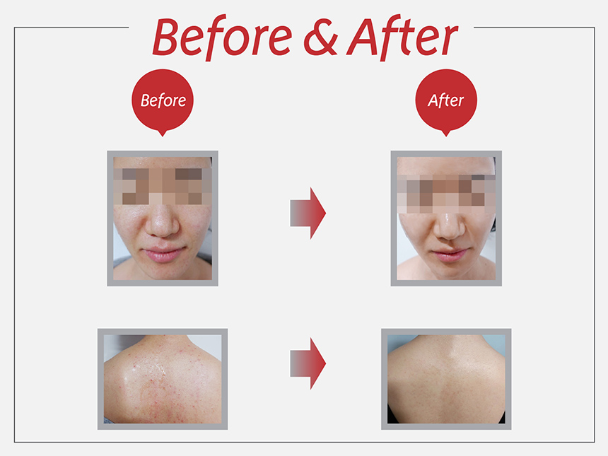 NEW SKIN MASQUE mts bag aging rice mask pack