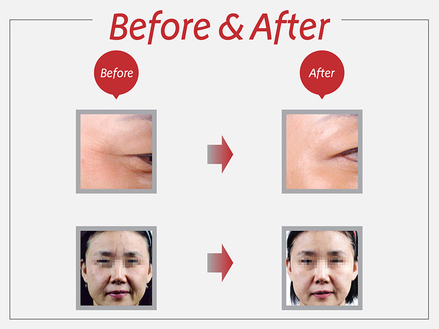 NEW SKIN MASQUE mts bag aging rice mask pack