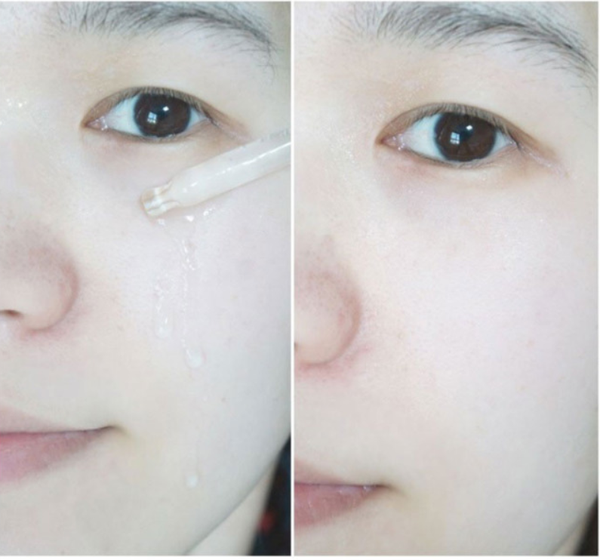 LAF Tea Tree Bafar Ampoule 30ml Shiny face Light s