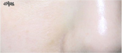 LAF Tea Tree Bafar Ampoule 30ml Shiny face Light s