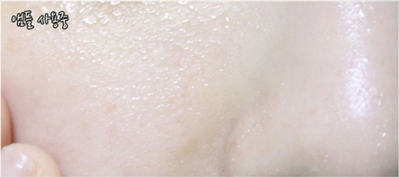 LAF Tea Tree Bafar Ampoule 30ml Shiny face Light s